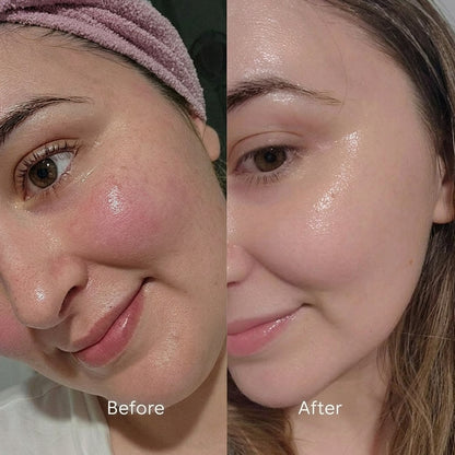 7 Days Mein Glass Skin? ✨ Torriden Dive-In Hydrating Serum | Korea's #1 Serum 2026