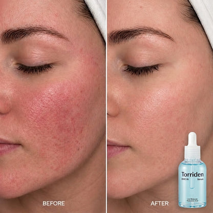 7 Days Mein Glass Skin? ✨ Torriden Dive-In Hydrating Serum | Korea's #1 Serum 2026